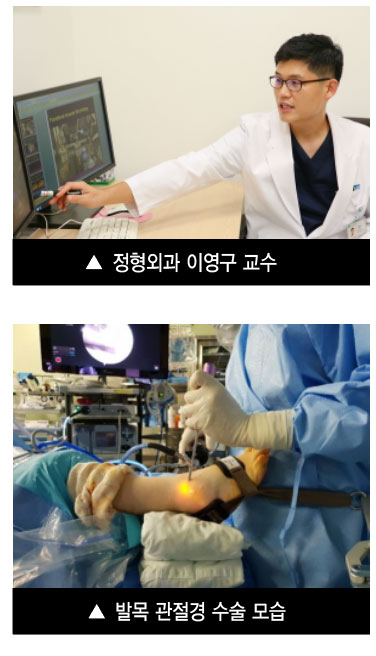 발목관절경수술