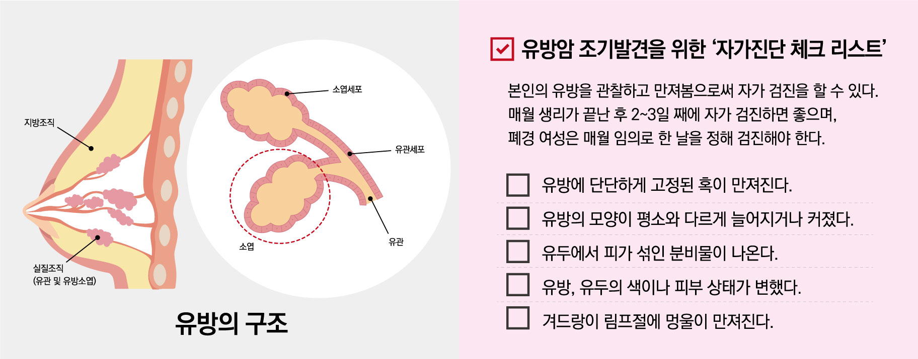 유방암 조기발견을 위한 자가진단 체크리스트 본인의 유방을 관찰하고 만져봄으로써 자가 검진을 할 수 있다. 매월 생리가 끝난 후 2~3일 째에 자가 검진하면 좋으며, 폐경 여성은 매월 임의로 한 날을 정해 검진해야 한다. 1. 유방에 단단하게 고정된 혹이 만져진다. 2. 유방의 모양이 평소와 다르게 늘어지거나 커졌다. 3. 유두에서 피가 섞인 분비물이 나온다. 4. 유방, 유두의 색이나 피부 상태가 변했다. 5. 겨드랑이 림프절에 멍울이 만져진다.