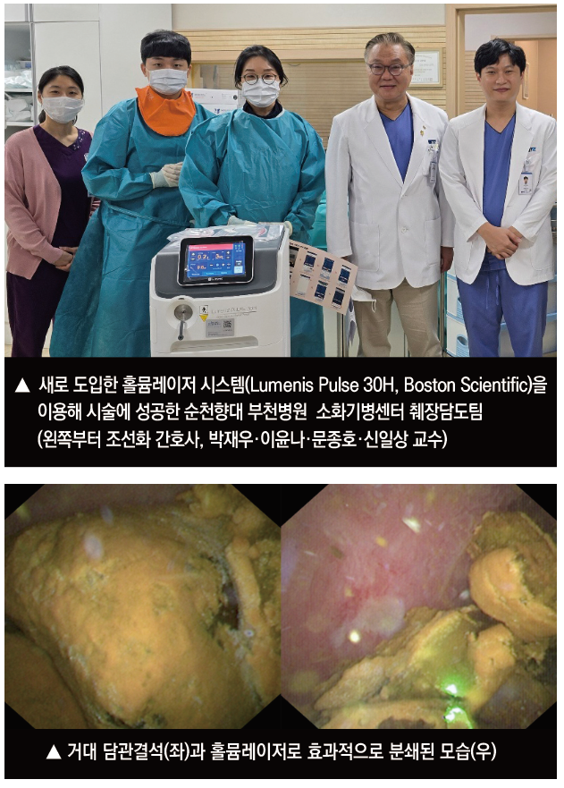 홀뮴레이저 쇄석술 장비