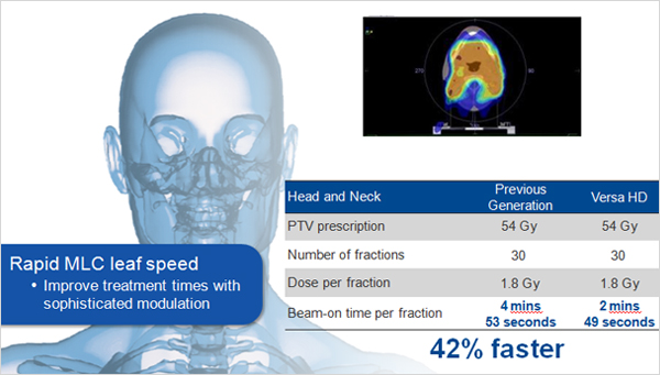 Head and Neck Case - Rapid MLC leaf speed Improve treatment times with sophistcated modulation 42% faster 