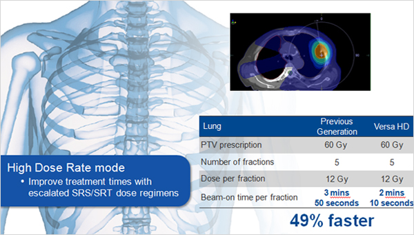 Lung Case - High Dose Rate mode Impove treatment tiomes with escalated SRS SRT dose regimens 49% faster 